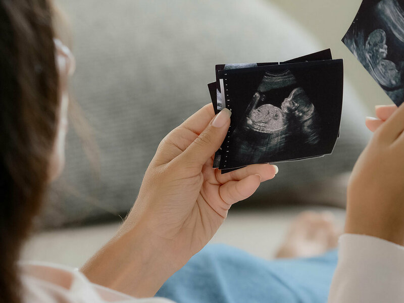 Schwangere Frau schaut sich Ultraschallbilder an.